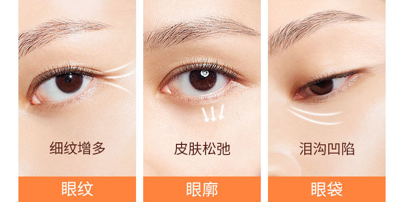 细纹增多/眼纹, 皮肤松弛/眼廓, 泪沟凹陷/眼袋