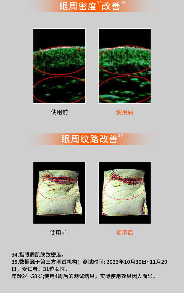 雪花秀人参眼霜