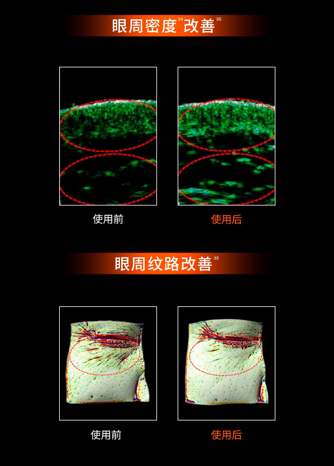 雪花秀御时参养眼霜