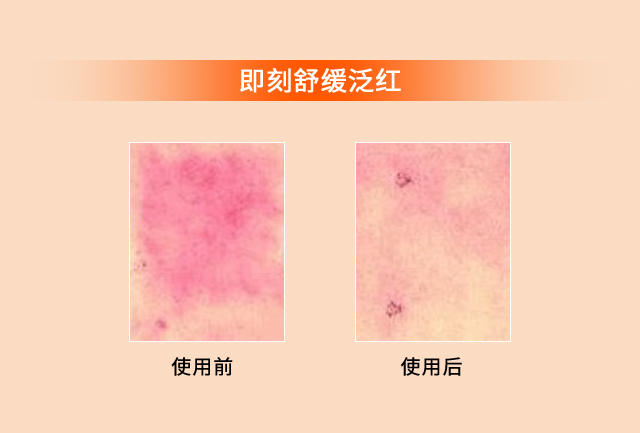 滋盈生人参密集修护精华液