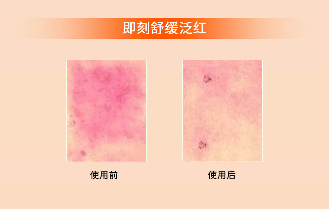 滋盈生人参密集修护精华液