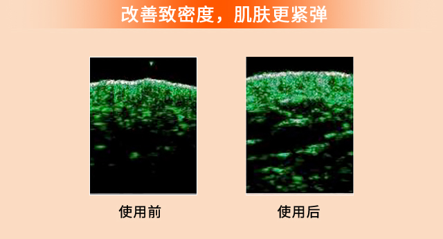 滋盈生人参密集修护精华液