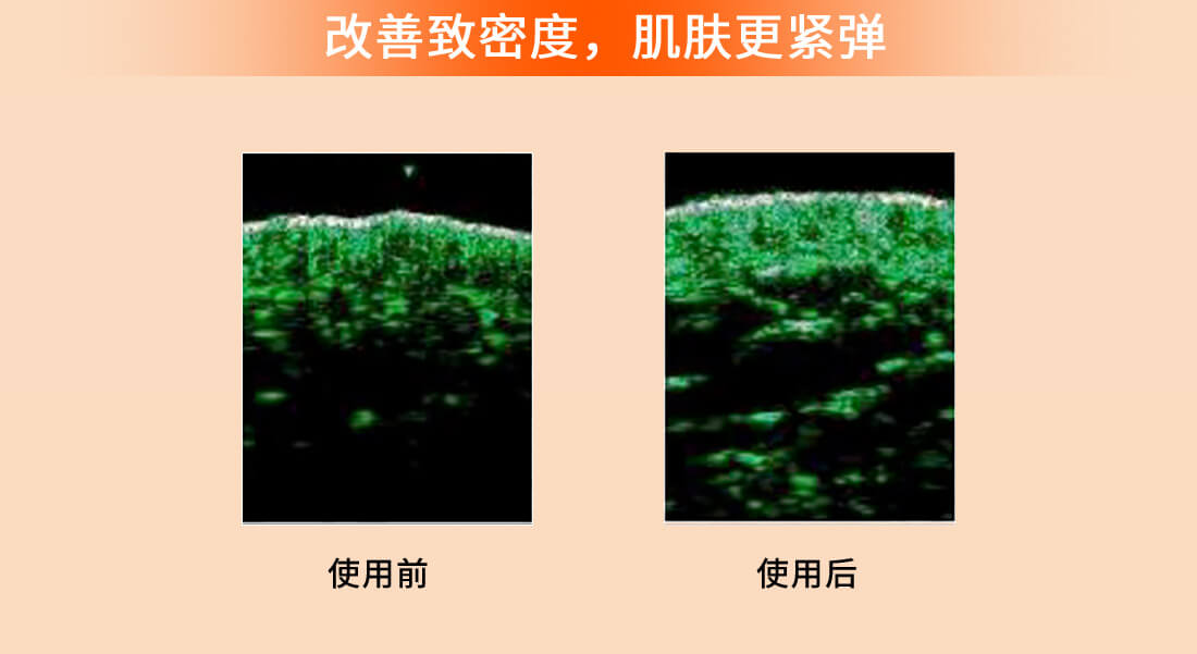 滋盈生人参密集修护精华液