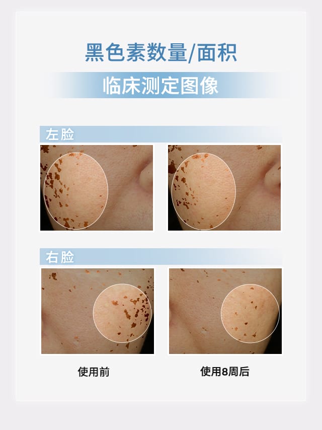 雪花秀滋晶臻白密集精华露