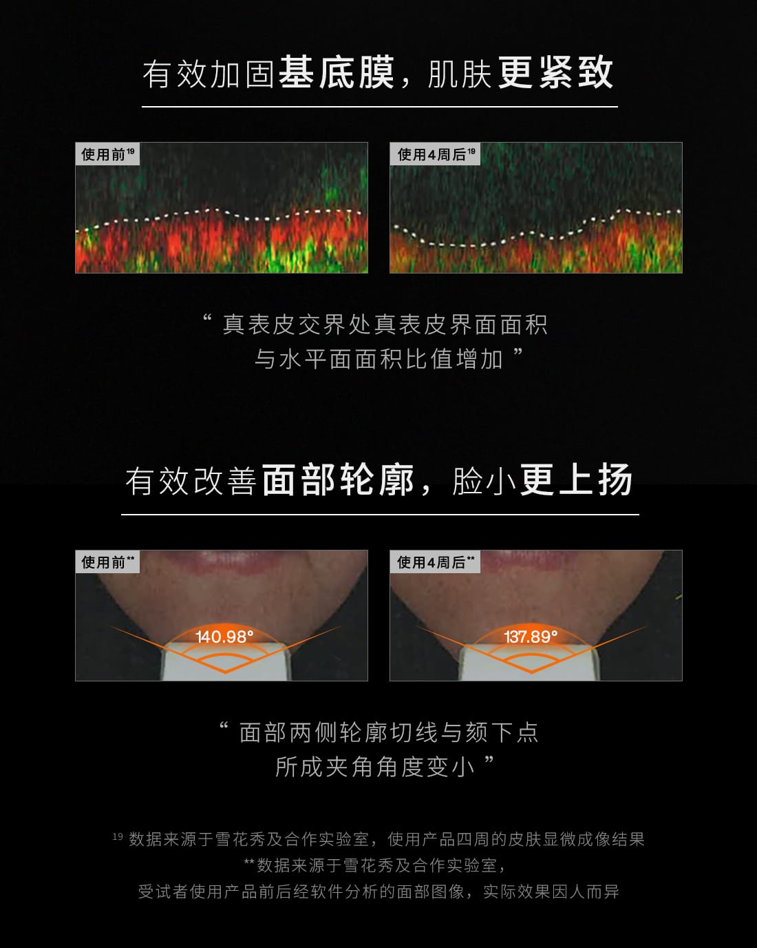 雪花秀菁典臻秀精萃水